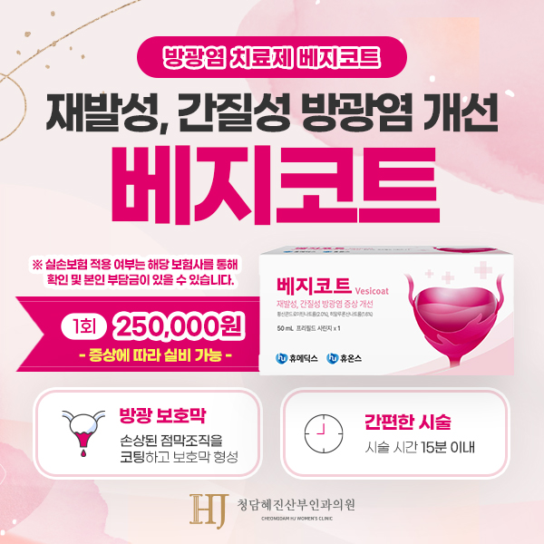 팝업